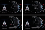 BMW iX3 Impressive Impressive Todo terreno Interior Cuadro de instrumentos 5 puertas